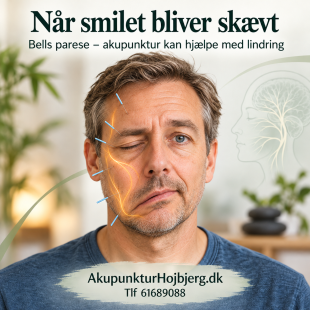 Når smilet bliver skævt